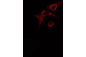 ABIN6274490 staining Hela cells by IF/ICC. (ADPGK antibody  (Internal Region))