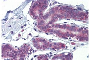 Immunohistochemistry (IHC) image for anti-Leucine Zipper, Down-Regulated in Cancer 1 (LDOC1) (N-Term) antibody (ABIN2780876)