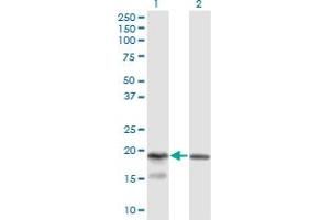 Western Blot analysis of KLRC4 expression in transfected 293T cell line by KLRC4 monoclonal antibody (M03), clone 1D10. (KLRC4 antibody  (AA 1-158))