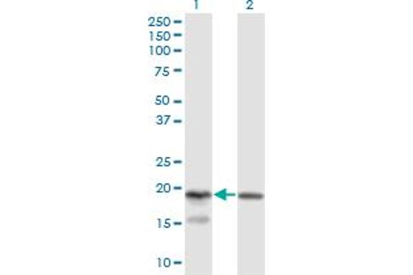 KLRC4 anticorps  (AA 1-158)