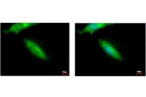 ICC/IF Image HIP55 antibody [N1], N-term detects DBNL protein at cytoplasm by immunofluorescent analysis. (DBNL antibody  (N-Term))