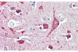 Detection of DDR2 in Human Cerebrum Tissue using Polyclonal Antibody to Discoidin Domain Containing Receptor 2 (DDR2) (DDR2 antibody  (AA 578-817))