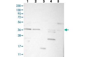 Western blot analysis of Lane 1: RT-4, Lane 2: U-251 MG, Lane 3: Human Plasma, Lane 4: Liver, Lane 5: Tonsil with C17orf81 polyclonal antibody  at 1:250-1:500 dilution.