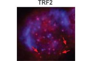 TRF2 Immunofluorescence.