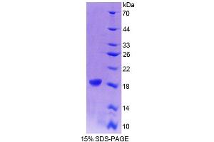 SDS-PAGE (SDS) image for Cellular Retinoic Acid Binding Protein 1 (CRABP1) (AA 2-137) protein (His tag) (ABIN4989218)