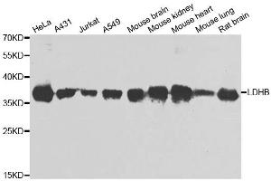 Western blot analysis of extracts of various cell lines, using LDHB antibody. (LDHB antibody)
