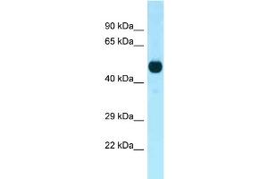 WB Suggested Anti-Cdk14 Antibody Titration: 1. (CDK14 antibody  (C-Term))
