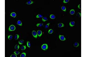 Immunofluorescence (IF) image for anti-WNT1 Inducible Signaling Pathway Protein 1 (WISP1) (AA 130-251) antibody (ABIN7175846)