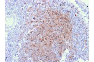 Formalin-fixed, paraffin-embedded human Lymph Node in Colon stained with CD72 Mouse Monoclonal Antibody (BU40). (CD72 antibody)