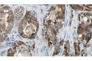 ABIN6277764 at 1/100 staining Human prostate tissue by IHC-P. (Golgin A2 (GOLGA2) (N-Term) antibody)
