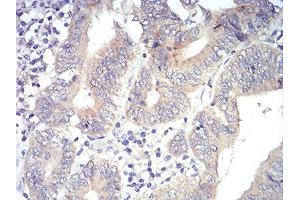 Immunohistochemical analysis of paraffin-embedded esophagus tissues using PLCG1 mouse mAb with DAB staining. (Phospholipase C gamma 1 antibody  (AA 1192-1291))