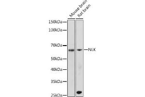 Western blot analysis of extracts of various cell lines, using NLK antibody (ABIN7268846) at 1:500 dilution. (Nemo-Like Kinase antibody)