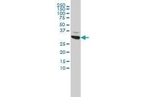 CBR1 monoclonal antibody (M02), clone 4D12-1G8 Western Blot analysis of CBR1 expression in Hela . (CBR1 antibody  (AA 1-277))