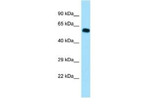 WB Suggested Anti-SGOL1 Antibody Titration: 1. (Shugoshin antibody  (C-Term))