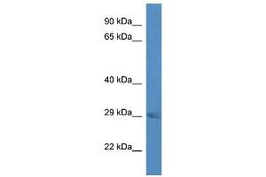 WB Suggested Anti-Rab23 Antibody Titration: 1. (RAB23 antibody  (Middle Region))