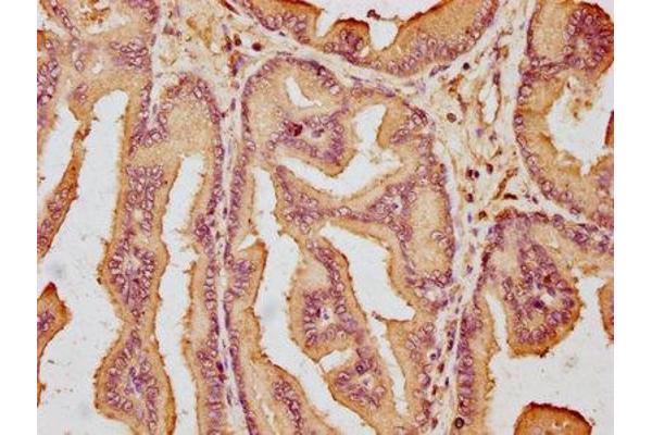 GLIPR2 antibody  (AA 2-85)