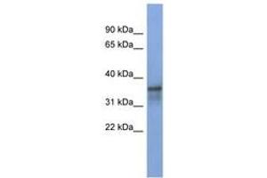 Image no. 1 for anti-RNA Binding Motif Protein 9 (RBM9) (AA 287-336) antibody (ABIN6743007)