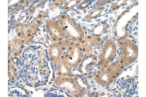 SLC39A6 antibody was used for immunohistochemistry at a concentration of 4-8 ug/ml to stain Epithelial cells of renal tubule (arrows) in Human Kidney. (SLC39A6 antibody)