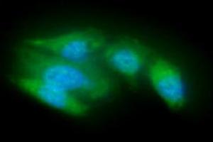 ICC/IF analysis of ACOT8 in A549 cells line, stained with DAPI (Blue) for nucleus staining and monoclonal anti-human ACOT8 antibody (1:100) with goat anti-mouse IgG-Alexa fluor 488 conjugate (Green). (ACOT8 antibody)
