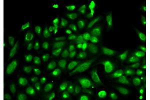 Immunofluorescence analysis of HeLa cells using SPHK1 antibody. (SPHK1 antibody)