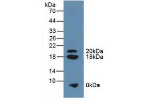 SPINK1 Antikörper  (AA 26-78)