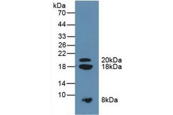 SPINK1 antibody  (AA 26-78)
