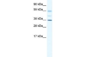 WB Suggested Anti-SOX17 Antibody Titration: 0. (SOX17 antibody  (C-Term))