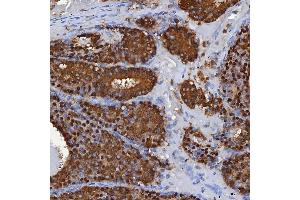 IHC analysis of SBP/SELENBP1 using anti-SBP/SELENBP1 antibody (ABIN7600755). (SELENBP1 antibody  (AA 23-462))