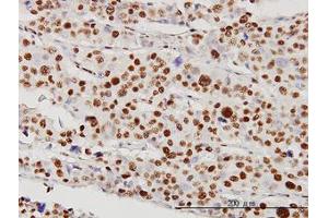 Image no. 4 for anti-serine/threonine Kinase 38 (STK38) (AA 1-466) antibody (ABIN599179) (STK38 antibody  (AA 1-466))