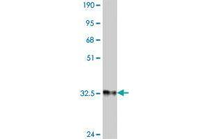 Western Blot detection against Immunogen (34. (BATF3 antibody  (AA 48-125))