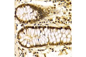 Immunohistochemistry of paraffin-embedded human colon using KPNA4 Antibody (ABIN5971058) at dilution of 1/100 (40x lens). (KPNA4 antibody)