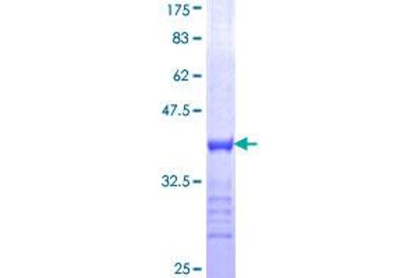 MYT1 Protein (AA 586-685) (GST tag)