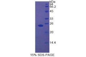 SDS-PAGE (SDS) image for Androgen Receptor (AR) (AA 491-679) protein (His tag) (ABIN1098844) (Androgen Receptor Protein (AR) (AA 491-679) (His tag))