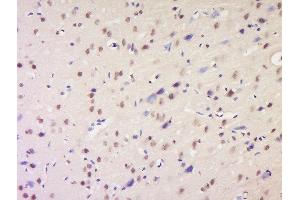 Formalin-fixed and paraffin embedded rat brain labeled with Anti-NSD1 Polyclonal Antibody, Unconjugated  at 1:200 followed by conjugation to the secondary antibody and DAB staining. (NSD1 antibody  (AA 2401-2600))