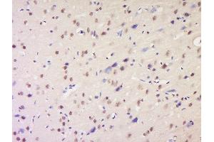 NSD1 antibody  (AA 2401-2600)
