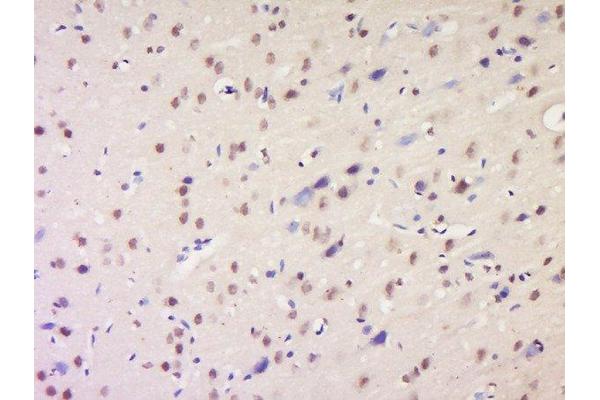 NSD1 antibody  (AA 2401-2600)