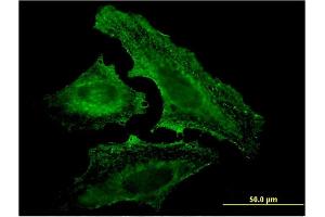 Immunofluorescence of monoclonal antibody to UVRAG on HeLa cell. (UVRAG antibody  (AA 601-699))