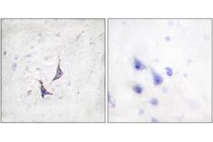 Immunohistochemistry analysis of paraffin-embedded human brain tissue, using Syndecan4 (Ab-179) Antibody. (SDC4 antibody  (AA 145-194))