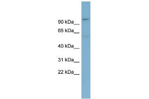 WB Suggested Anti-TBL3 Antibody Titration: 0.