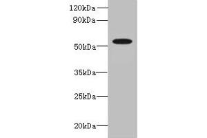 Western blot All lanes: L2HGDH antibody at 8 μg/mL + K562 whole cell lysate Secondary Goat polyclonal to rabbit IgG at 1/10000 dilution Predicted band size: 51, 49 kDa Observed band size: 51 kDa (L2HGDH antibody  (AA 52-463))