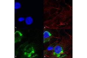 Immunocytochemistry/Immunofluorescence analysis using Mouse Anti-GFAP R416WT Monoclonal Antibody, Clone S206B-9 (ABIN1740964). (GFAP antibody  (AA 411-422) (Atto 390))