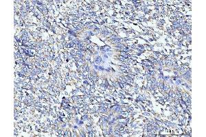 IHC analysis of TARS2 using anti-TARS2 antibody (ABIN7602308).