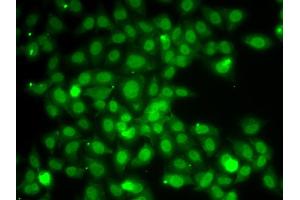 Immunofluorescence analysis of A549 cells using TRAF4 antibody. (TRAF4 antibody)