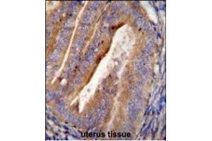 OGN Antibody (C-term) (ABIN655617 and ABIN2845097) immunohistochemistry analysis in formalin fixed and paraffin embedded human uterus tissue followed by peroxidase conjugation of the secondary antibody and DAB staining. (OGN antibody  (C-Term))