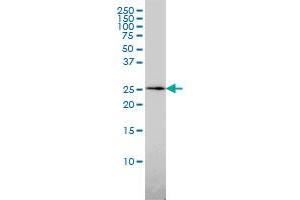 Western Blotting (WB) image for anti-Quinoid Dihydropteridine Reductase (QDPR) (AA 1-244) antibody (ABIN562551)