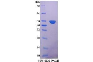 Image no. 1 for BMP Binding Endothelial Regulator (BMPER) (AA 40-298) protein (His tag) (ABIN4990816)