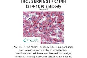 Image no. 1 for anti-Serpin Peptidase Inhibitor, Clade G (C1 Inhibitor), Member 1 (SERPING1) (AA 1-501), (full length) antibody (ABIN1723814) (SERPING1 antibody  (full length))