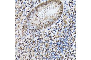 Immunohistochemistry of paraffin-embedded human appendix using hnRNPM antibody (ABIN6128031, ABIN6141919, ABIN6141920 and ABIN6222681) at dilution of 1:100 (40x lens). (HNRNPM antibody  (AA 491-730))