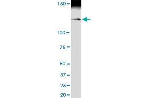 Immunoprecipitation of MYBBP1A transfected lysate using anti-MYBBP1A MaxPab rabbit polyclonal antibody and Protein A Magnetic Bead , and immunoblotted with MYBBP1A MaxPab mouse polyclonal antibody (B01) . (MYBBP1A antibody  (AA 1-1328))