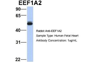 Host:  Rabbit  Target Name:  EEF1A2  Sample Type:  Human Fetal Heart  Antibody Dilution:  1. (EEF1A2 antibody  (Middle Region))
